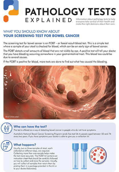Bowel Cancer
